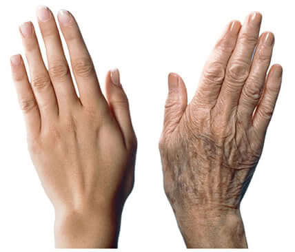 手の老化を防ぐ7つのアドバイス