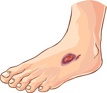 切断