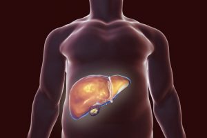 肝臓のデトックスに役立つ自然療法