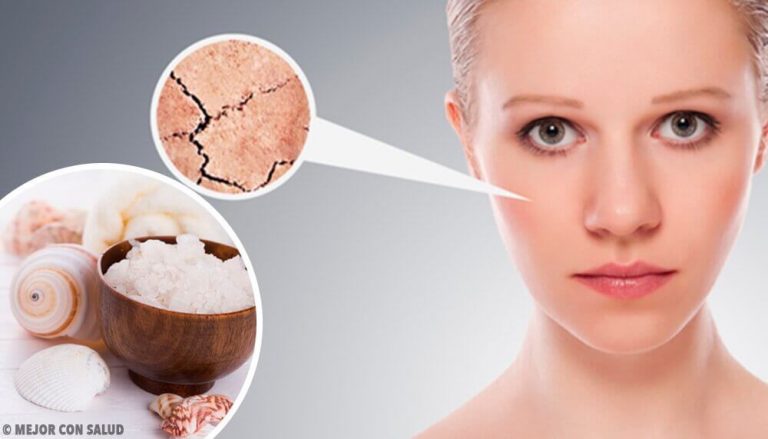 乾燥した皮膚を取り除く5つの自然療法