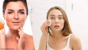 乾燥肌をしっかりと治す方法