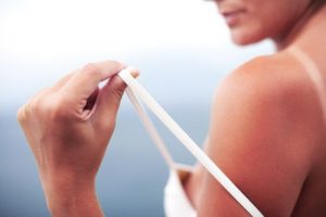 日焼け の症状を緩和する5つの自然療法
