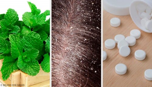 自宅で出来るフケ対策 7選