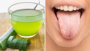 舌の白さを解消する7つの自然療法