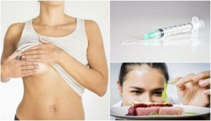 乳房嚢胞の治療法