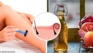 カミソリ負けに効く自然療法5選