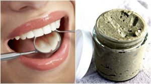 100%自然の力を使って虫歯を予防・治療する方法