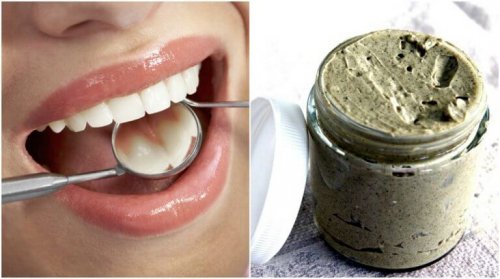 100％自然の力を使って虫歯を予防・治療する方法