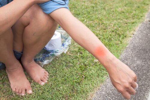 虫刺されの予防方法