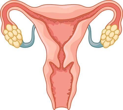 多嚢胞性卵巣症候群　不妊原因