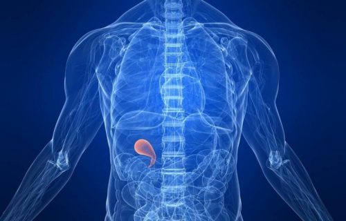 胆嚢摘出手術後に食べると良い食事