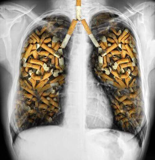 たばこの肺