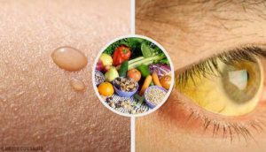 ビタミン欠乏症が引き起こす健康トラブル10