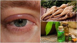 目の腫れを抑える5つの家庭療法