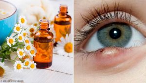 簡単なものもらいの治療法5選