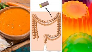 大腸内視鏡検査前の食事と準備