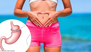 胃バイパス手術を受ける利点と副作用