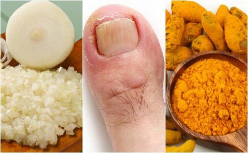爪のささくれからくる炎症を抑える6つの自然療法