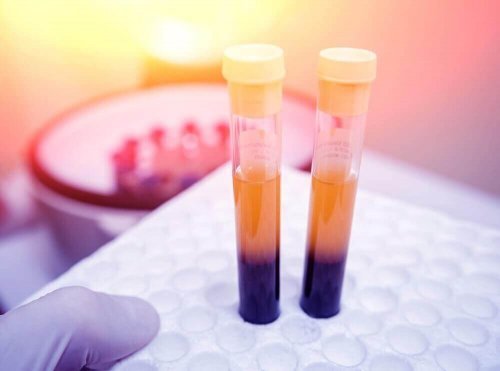 血小板の数を増やす効果が期待できる4つの自然療法