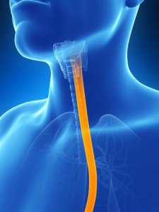 食道炎の症状を改善する5つの自然療法