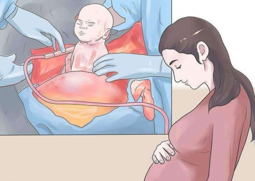 帝王切開の可能性について聞く女性