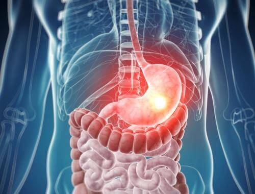 食物不耐性について