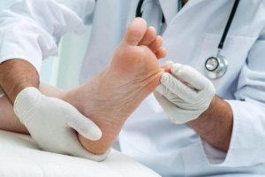 表在性真菌症を自然に治す7つの自宅療法