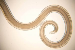 腸内寄生虫と戦う! ミントとスキムミルクの自然療法