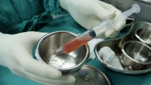 ご存知ですか?腹水に関する有益な情報と治療法