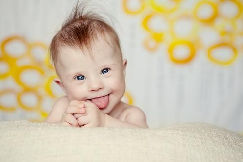 ダウン症の子どもを育てる