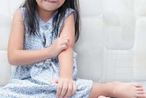 子どもが乾癬になったらどうする?