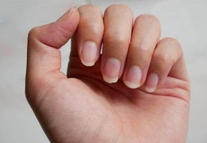爪を美しく強くする9つの自然療法とは?