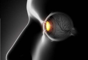 早期診断が大事!斜視の症状と治療法について