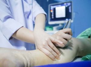 深部静脈血栓症の診断および予防法