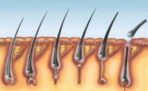 多発石灰化上皮腫症候群とは
