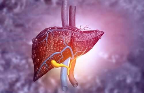 肝臓 HIV治療に使われるアバカビルとその副作用