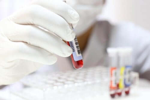 血液検査を受ける頻度の目安とは？　分析