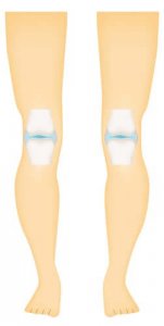 関節の健康を守ろう!滑膜関節とその特徴について