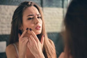 生理中の女性にニキビができやすいのはなぜ?