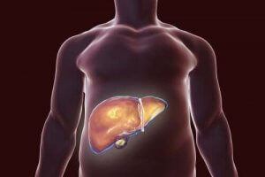 胆嚢に優しい食生活のススメ