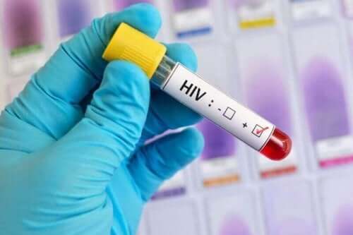 世界エイズデーについて知っておくべきすべてのこと 血液検査