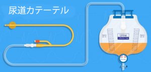 産後よくある尿トラブル、尿閉を治す方法