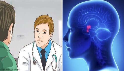 下垂体腺腫とは何ですか? 医者と患者