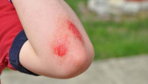 切り傷や擦り傷を緩和するセージとハチミツの自然療法 子供の怪我