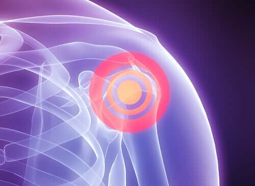 肩腱板断裂：リハビリテーションの段階  　肩の痛み