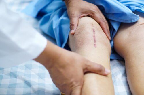 人工膝関節移植手術後の回復を早めるポイントとは
