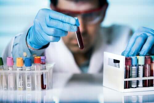 HIV感染者は新型コロナウイルスの危険によりさらされますか? 試験管を持った男性