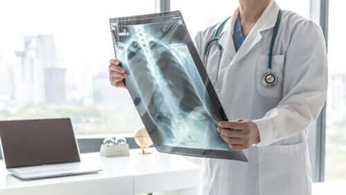 肺のレントゲン写真を見る医師
