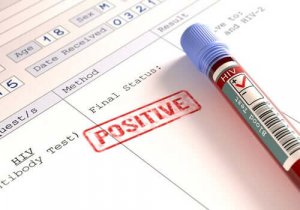HIV感染者は新型コロナウイルスの危険によりさらされますか?