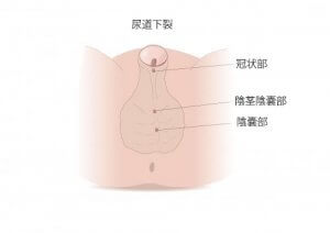 知っておきたい!尿道下裂の症状と治療について